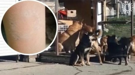Стая бродячих собак покусала ребенка в Новороссийске